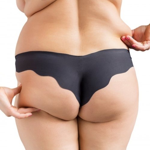 Brazilian Butt (Fat Grafting)